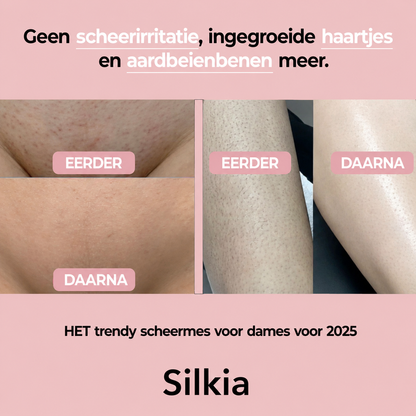 Silkia — Precision Trimmer | Voor Gevoelige Zones