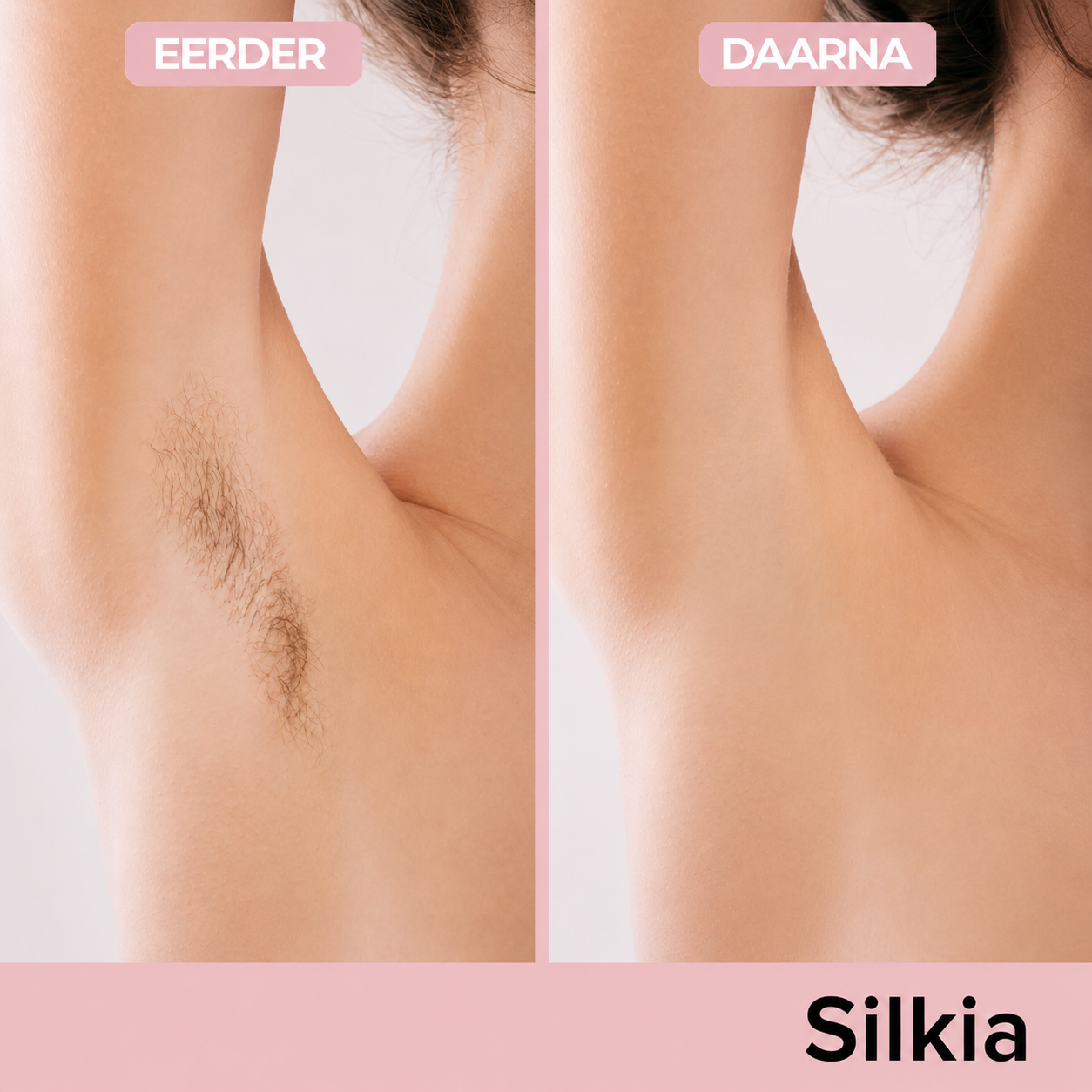 Silkia — Precision Trimmer | Voor Gevoelige Zones