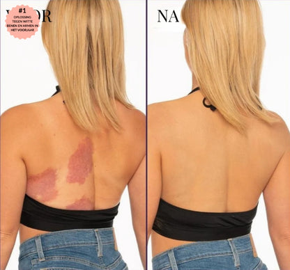 Body coverage perfector