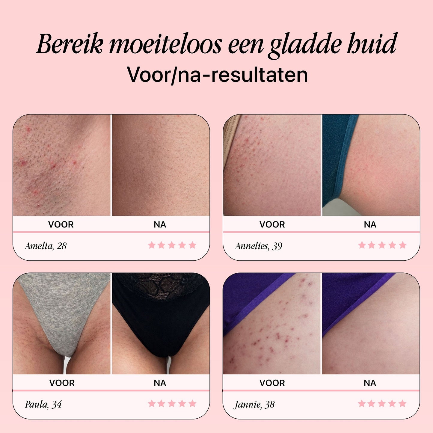 Premium RoseGold Veiligheidsscheermes - Tijdelijk 10 reservemesjes Gratis