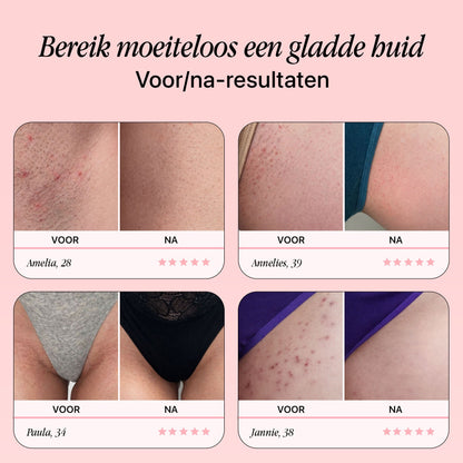Premium RoseGold Veiligheidsscheermes - Tijdelijk 10 reservemesjes Gratis